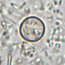 Image result for Cyclospora