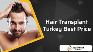 Average facial hair transplant cost according to the american society of plastic surgeons (us), the average cost of hair transplant in the us is $3,000. Hair Transplant Turkey Best Price Asli Tarcan Clinic