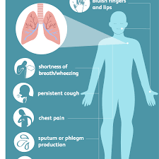 Maybe you would like to learn more about one of these? Emphysema Overview And More