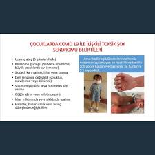 Hacettepe Universitesi Tip Fakultesi Cocuk Enfeksiyon Hastaliklari Bilim Dali Baskani Prof Dr Mehmet Ceyhan Cocuklarda Kovid 19 2020 Tip Fakultesi Tip Instagram