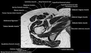 Check spelling or type a new query. Mri Anatomy Of Hip Joint Free Mri Axial Hip Anatomy