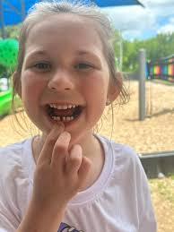 LuLu pulled her tooth and we had a day where 2 girls lost a tooth
