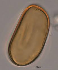 Image result for Vittaria elongata