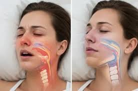 Coon Rapids man allegedly set home