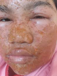 Malaysian Lady Rushed To Emergency Ward After Using Fake Aloe Vera Gel World Of Buzz