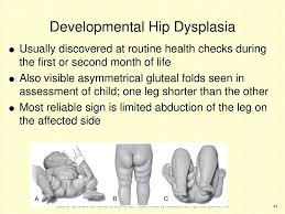 The Newborn With A Perinatal Injury Or Congenital Malformation Ppt Download