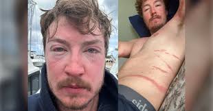 Ultra-endurance athlete Nick Pelletier knew the Hawaiian channel he planned  to swim had plenty of sharks, but he should have been worried about the  jellyfish. Click the link in our bio, visit