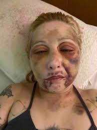 Carol Slusser's Instagram, Twitter & Facebook