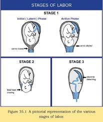 Stages Of Labour And Birthing Positions