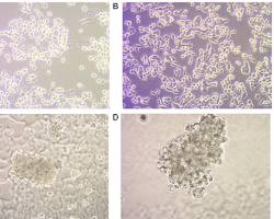 colon cancer cell under a microscopeの画像