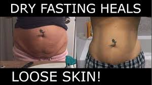 Dry Fasting Heals Loose Skin Youtube Dry Skin Diet Loose Skin Cream For Dry Skin