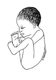 Emergency Childbirth Wikipedia