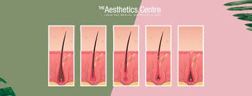 Laser hair removal is becoming more common and more available as a viable option for most people consider hair removal a luxury instead of a need, so if they think it is too expensive it can we'll give you a good idea of how to prepare for laser hair removal, the results you may experience. 12 Facts On Laser Hair Removal Results Costs And More
