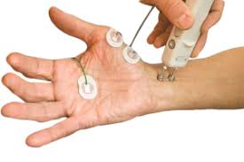 Image result for Nerve Conduction Velocity