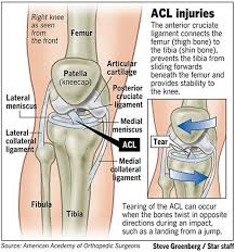 The most common injury is a complete tear. Pin On Knees