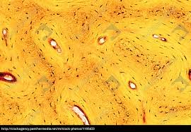 Thin section of dinosaur bone. Bone Tissue Of Humans Stock Photo 1105633 Panthermedia Stock Agency