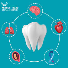The Surprising Link Between Dental Hygiene and Your Overall Health -  Kennett Road Dental Surgery Oxford
