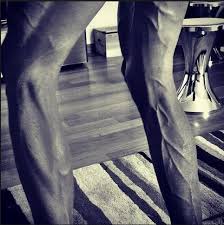 The legs of poland's pawel poljanski (left) look a little less arresting as he competes in the 17th stage of the tour de france in the french alps. Cyclist Tomasz Marczynski Shows Off Gruesome Legs As Training Takes Toll