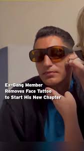 Former #gang member David Loya has taken part in Loma Linda University's  free #TattooRemoval program in #California.