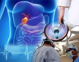 Kapil agrawal visit our website www.habi. Gallbladder Cancer Surgery Cost India Top Gallbladder Cancer Hospitals India