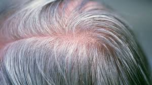 With age comes a reduction of melanin, meaning hair turns gray and eventually white. Can Stress Turn Your Hair Grey Overnight Bbc Future