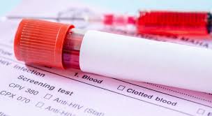 Image result for Screening Test