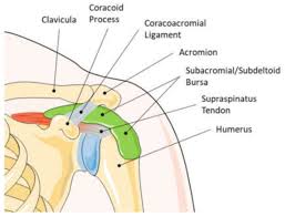 Image result for Subacromial Space Injection