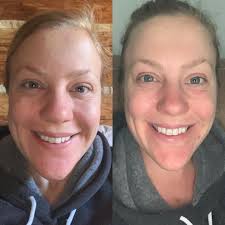 Is a poofy face a motivation to stay caffeine-free?