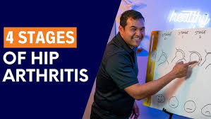 Image result for Resisted External Derotation Test