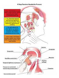 trigger point therapy tension type headaches tth