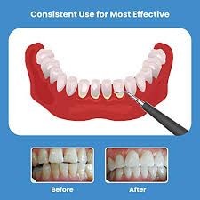 We did not find results for: Electric Dental Tartar Calculus Plaque Remover With Mouth Mirror Rechargeable Tooth Scraper Polisher With Replacement Heads Professional Dental Scaler Cleaning Tool Kit Safe For Both Adult Kids Pricepulse