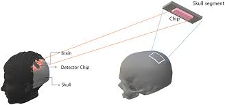 Frontiers Are Brain Computer Interfaces Feasible With Integrated Photonic Chips Neuroscience