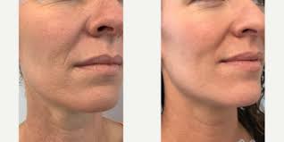 Maria Atkins, DO, Physician