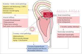 Atherosclerosis And Atrial Fibrillation Two Closely Intertwined Diseases Atherosclerosis