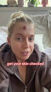 Protect Your Skin: Importance of Regular Skin Checks