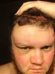 Fundraiser for Adam Martin by Becky Bowers-Pangle : Support for Adam Martin