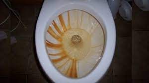 Maybe you would like to learn more about one of these? Toilet Bowl Ring 3 Different Types Ask A House Cleaner