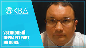 Узелковый полиартериит относится к редким заболеваниям: 1428 Uzelkovyj Periarteriit Na Kozhe Youtube