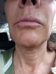 What a great and easy experience. Krave Medical Aesthetics 3305 W 144th Ave Ste 202 Broomfield Co Medical Spas Mapquest