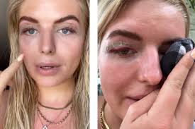 Antonia Hemmer unterzieht sich Beauty-OP: "Meine Augen fühlen sich schwer  an!"