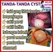 Inilah berbagai tanda tanda ovulasi yang paling akurat dan bisa diperhatikan untuk semua wanita. Tanda Tanda Cyst Atau Fibroid Tips Kesihatan Aabeauty Facebook