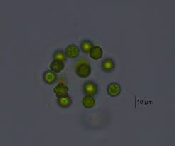 Image result for Sphaerocyperus