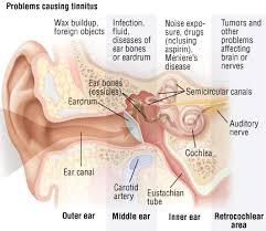 Common sources include hearing loss, ear wax buildup, ototoxic medications instead of causing hearing loss, as you might expect due to the lack of stimulation, the. Tinnitus Harvard Health