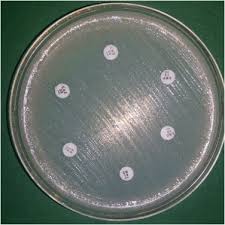 A number of strains have been identified. Clinical Manifestation And Outcomes Of Multi Drug Resistant Mdr Raoultella Terrigena Infection A Case Series At Indus Health Network Karachi Pakistan Sciencedirect