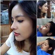 The Best Nose Augmentation In Thailand Plastic Surgery Cosmetic Surgery Plastic Surgery Photos