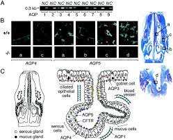 To solve problem, specialized organelle, concentration vacuole. Aquaporin 5 Dependent Fluid Secretion In Airway Submucosal Glands Journal Of Biological Chemistry
