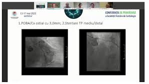 Spitalul clinic de urgență „prof. Simina Crisan Crisan Simina Twitter