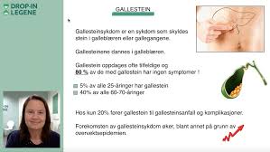Betent galleblære fjernes vanligvis med kirurgi. Gallestein Drop In Legene