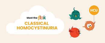 Image result for Homocystinuria