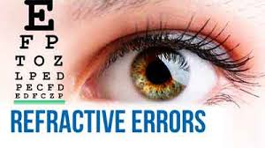Image result for Refractive Error